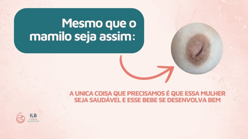 Mesmo que o mamilo seja assim